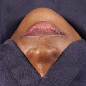 Dentist Face Drapes 02